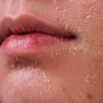 5 Tips penggunaan scrub muka yang betul